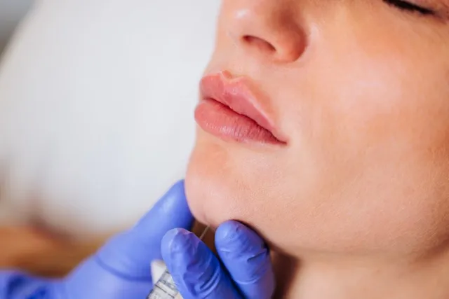 Injectable treatments to restore volume and reduce wrinkles, customized by Dr. Souphi.