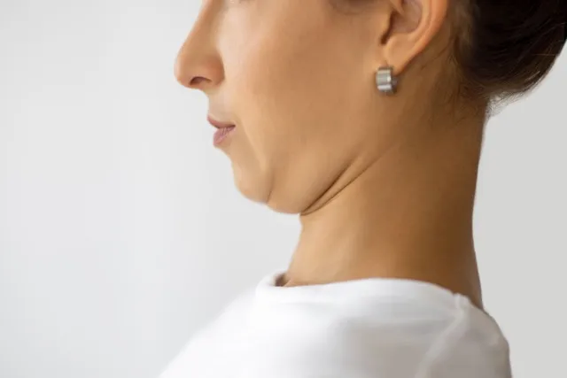 Double Chin Reduction