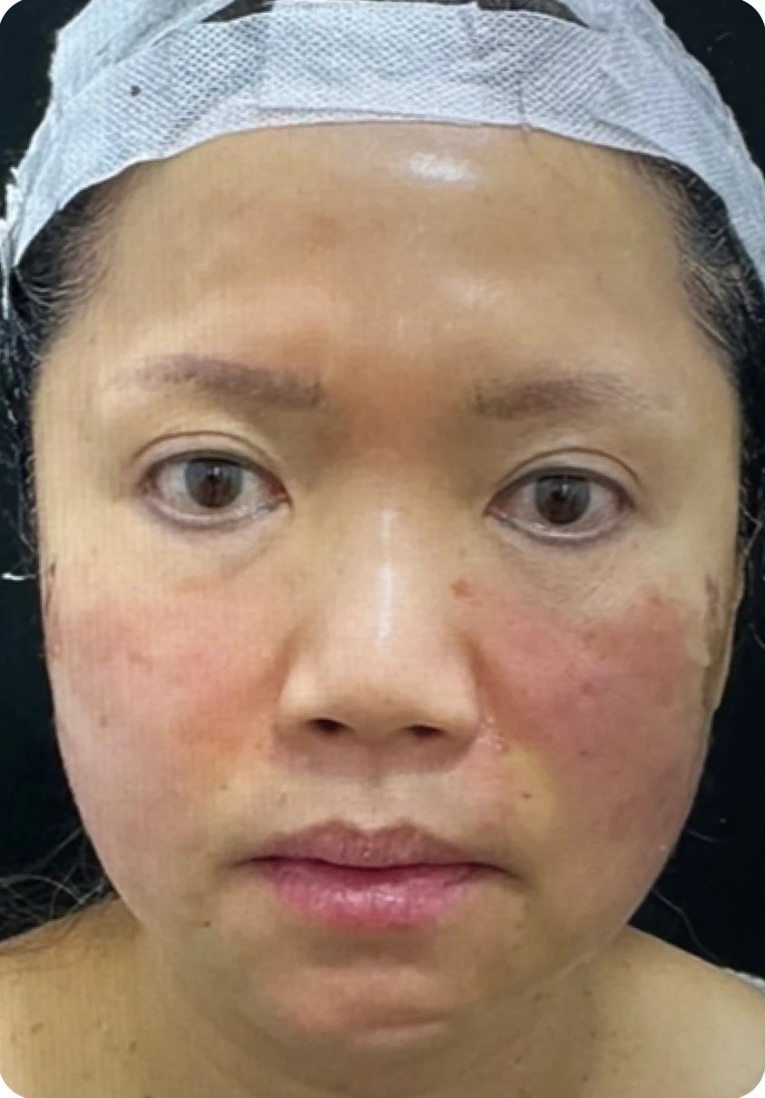 Silhouette Soft / APTOS / PDO Threads after